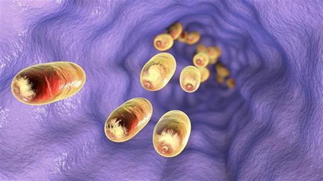 Η χειρουργική επέμβαση για την γαστροοισοφαγική παλινδρόμηση  μειώνει τον κίνδυνο οισοφαγικού καρκίνου