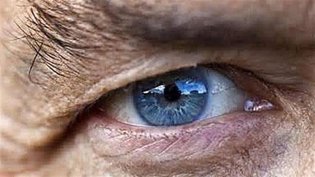 Νέας γενιάς laser κατά του γλαυκώματος