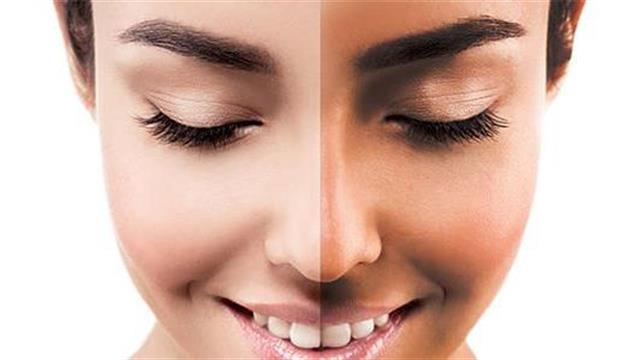 Πώς να απαλλαγείτε από το μαύρισμα