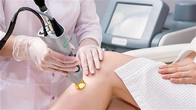 Αποτρίχωση με laser Αλεξανδρίτη: Τι να προσέξω πριν τη θεραπεία