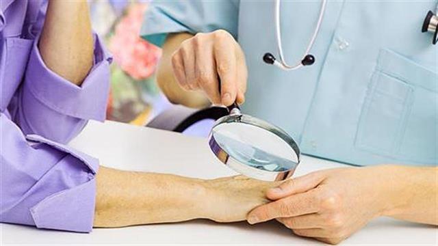 Ο FDA εγκρίνει το cemiplimab-rwlc για το προχωρημένο  πλακώδες καρκίνωμα του δέρματος