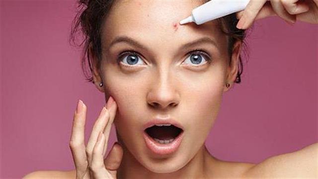 Τι σημαίνει να έχετε ορμονική ακμή;