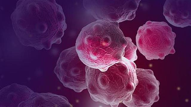 Καρκίνος παγκρέατος: Πώς αντιμετωπίζεται