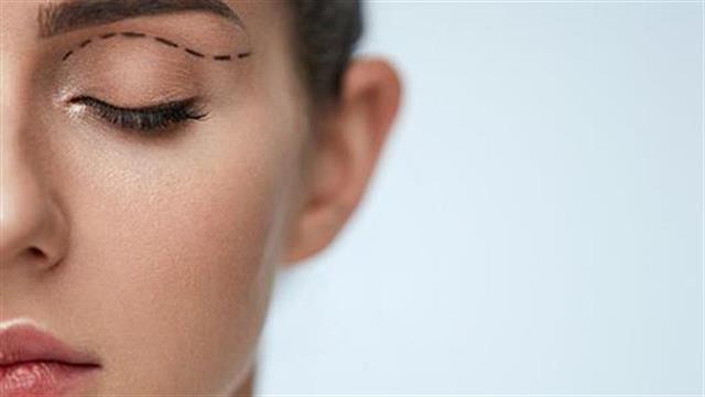 Βλεφαροπλαστική: Αναίμακτες και ανώδυνες οι σύγχρονες τεχνικές