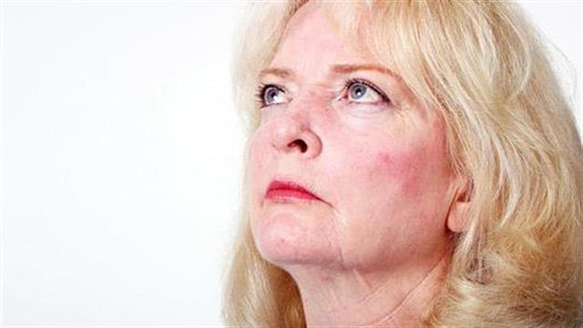 7 παθήσεις που προκαλούν κοκκίνισμα στο πρόσωπο