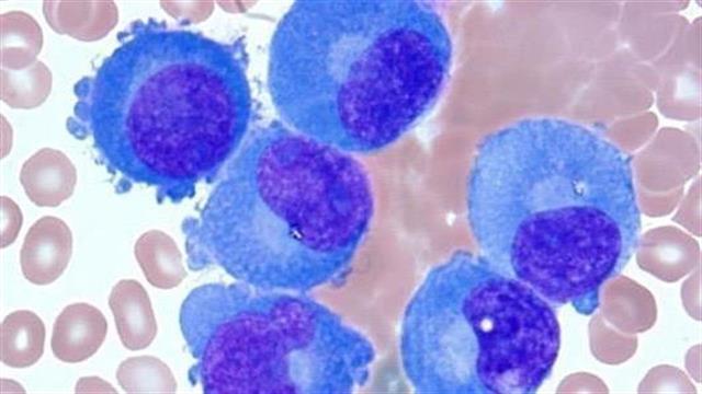 Nέα δεδομένα της Celgene  ενισχύουν το κλινικό όφελος των IMiDs® σε όλο το θεραπευτικό φάσμα του πολλαπλούν μυελώματος