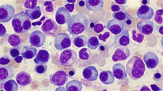 Σημαντικές μελέτες για τη λεμφοβλαστική αναιμία