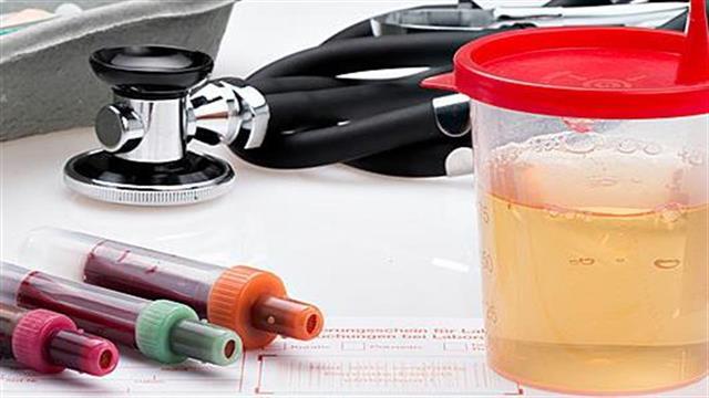 Αιματουρία: Πού μπορεί να οφείλεται;