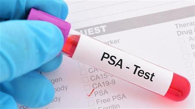 Τι είναι o προληπτικός έλεγχος του προστάτη και ποια η αξία του PSA