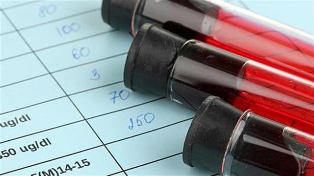 Εξέταση αίματος για τον εντοπισμό της νόσου Alzheimer 10 χρόνια πριν τα συμπτώματα