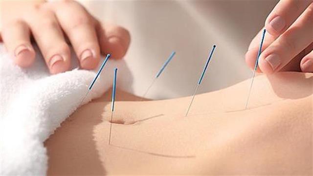 Βελονισμός και εμμηνόπαυση