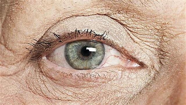 Γλαύκωμα: 9 ύποπτα συμπτώματα που δεν πρέπει ποτέ να αγνοείτε