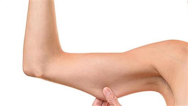 Χαλάρωση μετά από απώλεια βάρους; Όχι πια