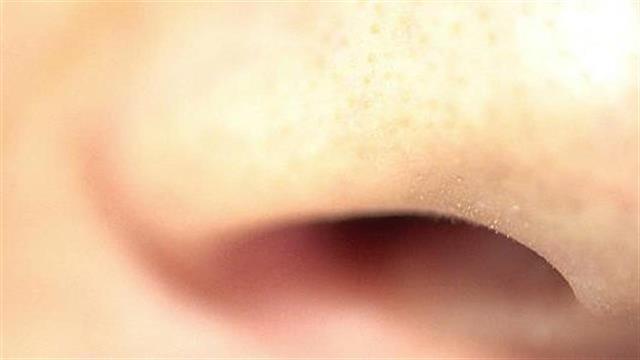 Μπορεί η ρινοπλαστική να διορθώσει μόνο τα μεγάλα ρουθούνια μου;