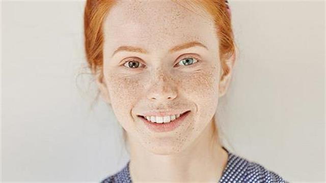 Τι λέει το χρώμα των ματιών για την υγεία μας