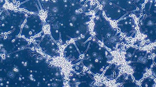 Δοκιμάζεται εμβόλιο για το γλοιοβλάστωμα