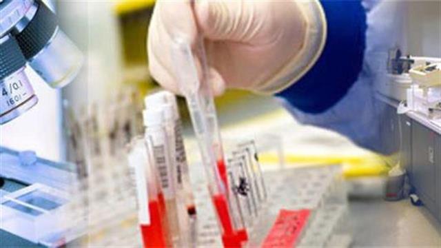 Μηδενική συμμετοχή σε διαγνωστικές εξετάσεις στον δημόσιο τομέα και σε μία σειρά παθήσεων