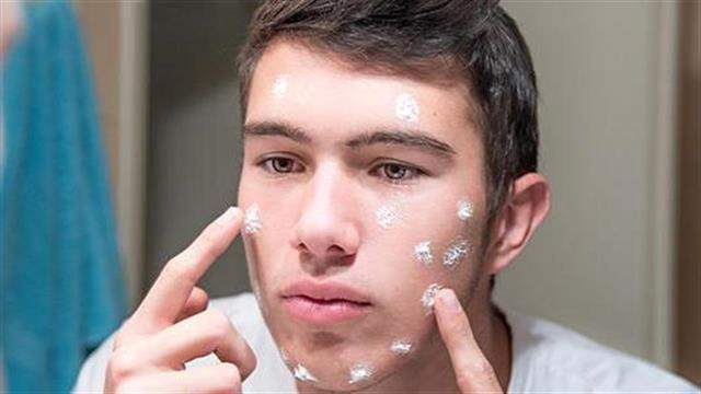 Η Νestle πουλά την Galderma για 10,2 δισ. ελβετικά φράγκα