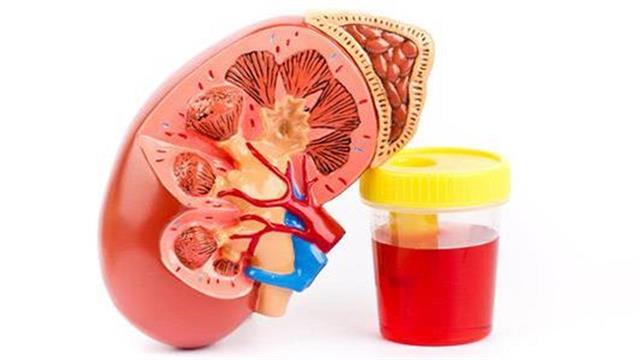 Aιματουρία στην παιδική και εφηβική ηλικία