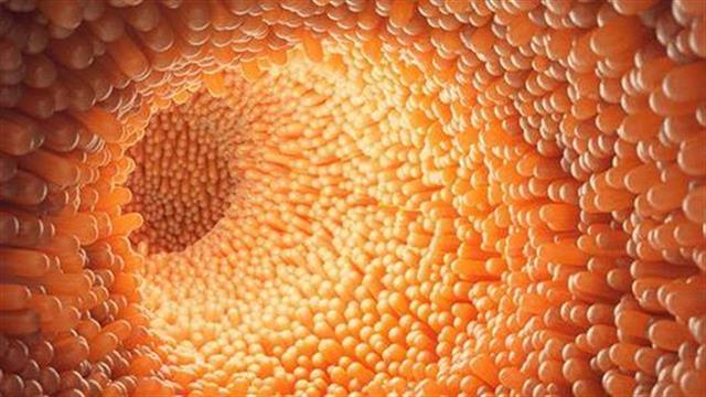 Ρομποτική χειρουργική: Νέες εξελίξεις στην αντιμετώπιση του καρκίνου του παχέος εντέρου