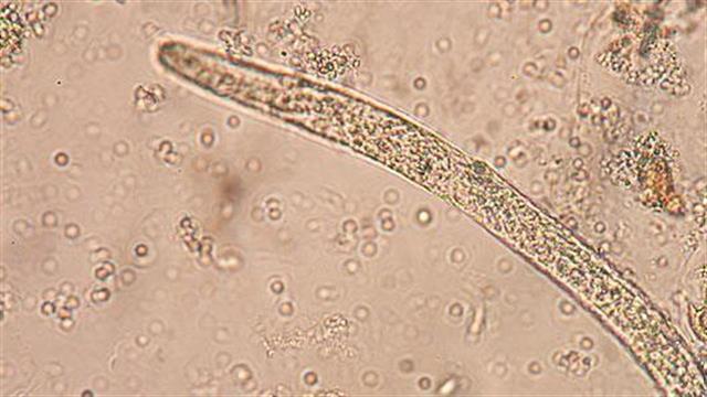 Απαγόρευση χρήσης νεονικοτινοειδών