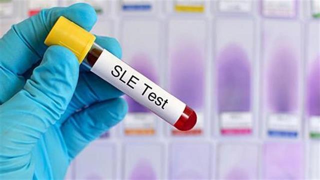 Συστηματικός Ερυθηματώδης Λύκος