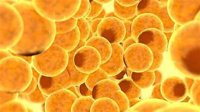 Ο ρόλος των λιποκυττάρων στο επιθετικό μελάνωμα