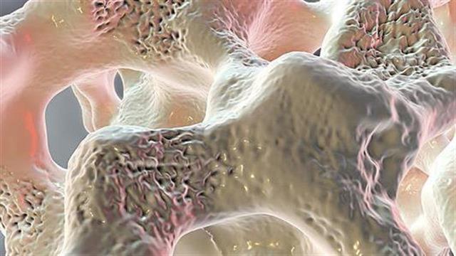 Οικογένειες με ιστορικό διαβήτη και αυξημένος κίνδυνος καταγμάτων