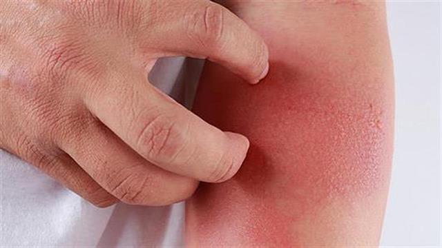 Η Sanofi και η Regeneron εγκαινιάζουν την πρωτοβουλία  ‘Agents of Change’ AD Challenge