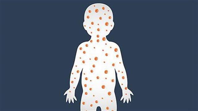 Πρόοδος στον περιορισμό της ερυθράς