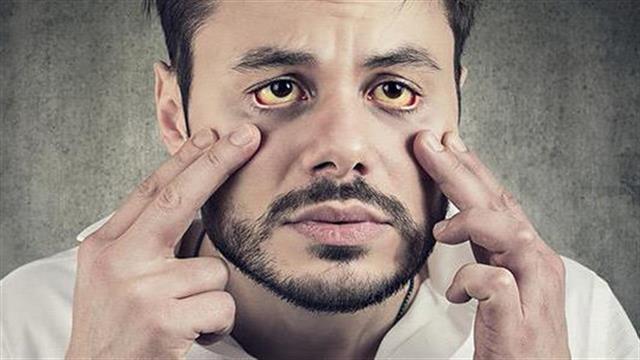 Η Gilead ανακοινώνει τους αποδέκτες δωρεών, για την υποστήριξη της εξάλειψης της ηπατίτιδας C στην Ελλάδα