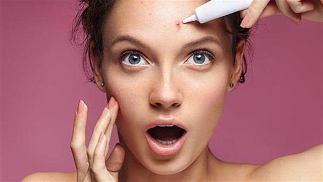 Ποιοι παράγοντες μπορεί να οδηγήσουν σε εξάρσεις της ακμής