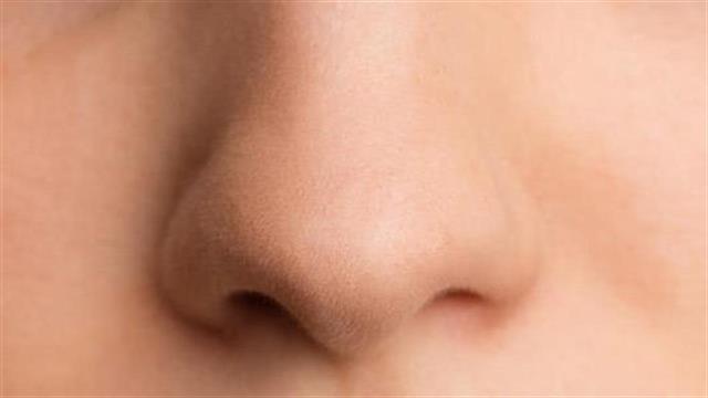 Το dupilumab έλαβε έγκριση στην Ε.Ε για τη σοβαρή χρόνια ρινοκολπίτιδα με ρινικούς πολύποδες