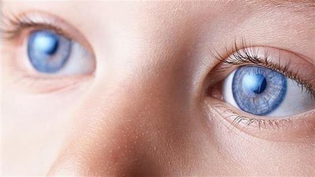 Εφαρμογή για smartphone εντοπίζει οφθαλμοπάθειες στις φωτογραφίες παιδιών