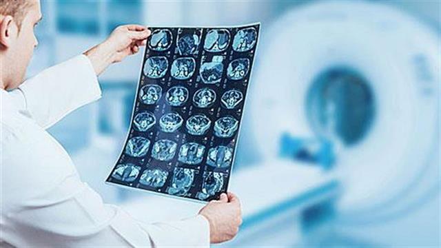 Έχουμε περισσότερους αξονικούς από την Ολλανδία!