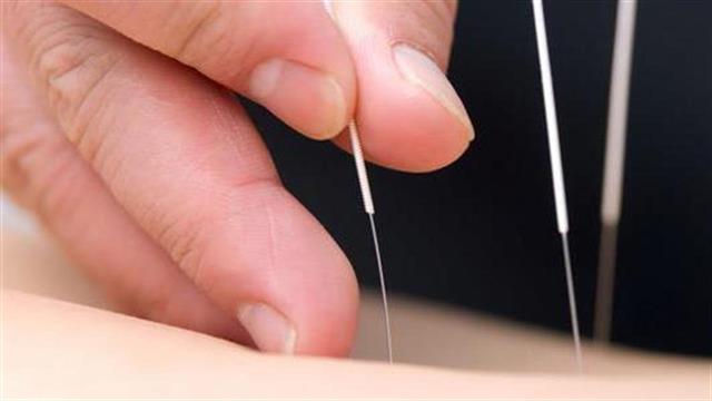 Ερευνα: Ο βελονισμός μειώνει την ξηροστομία λόγω ακτινοθεραπείας