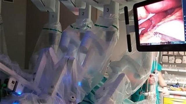 Γαστρική Παράκαμψη μίας Αναστόμωσης  με το ρομποτικό σύστημα DaVinciXi για πρώτη φορά στην Ελλάδα