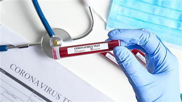 COVID 19 : Μικρότερες έρευνες δείχνουν επίδραση της υδροξυχλωροκίνης