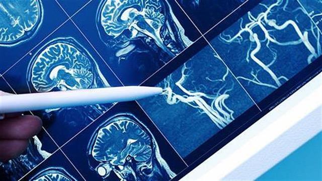 Ischemia Trial: ήρθε στην κατάλληλη στιγμή...