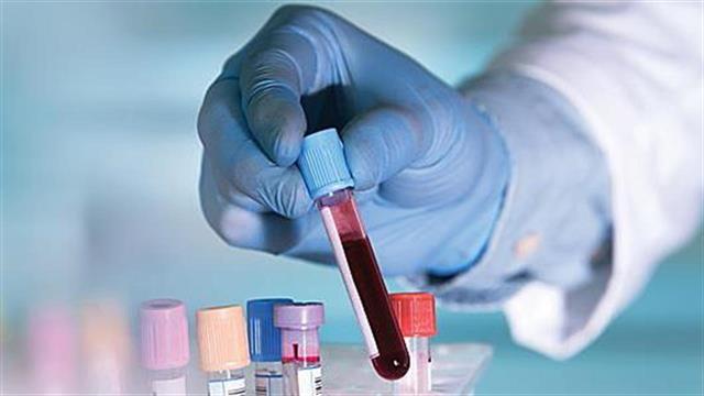 Συχνές οι αιματολογικές επιπλοκές της λοίμωξης από κορωνοϊό