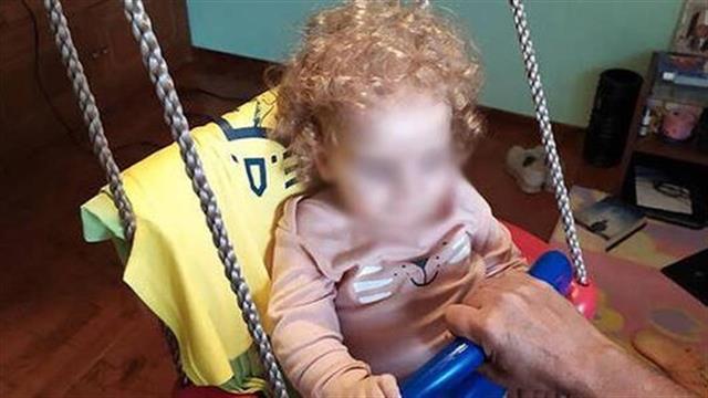 Νωτιαία μυϊκή ατροφία: Σχηματική απεικόνιση της ασθένειας του Παναγιώτη - Ραφαήλ