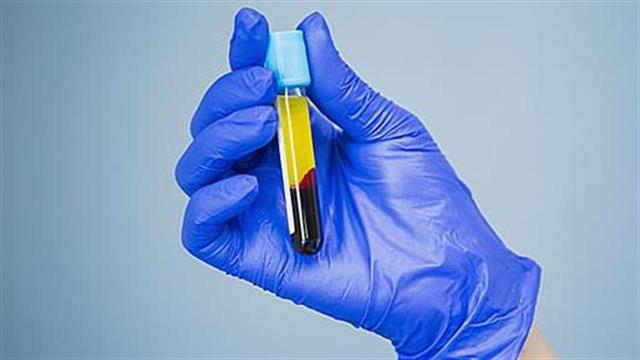 Η παγκόσμια ζήτηση πλάσματος θα φτάσει τα 50 εκατομμύρια λίτρα το 2020