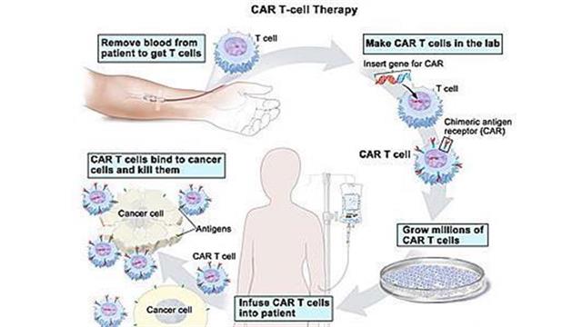 CAR-T λεμφοκύτταρα για την αντιμετώπιση ανθεκτικής μορφής λεμφώματος