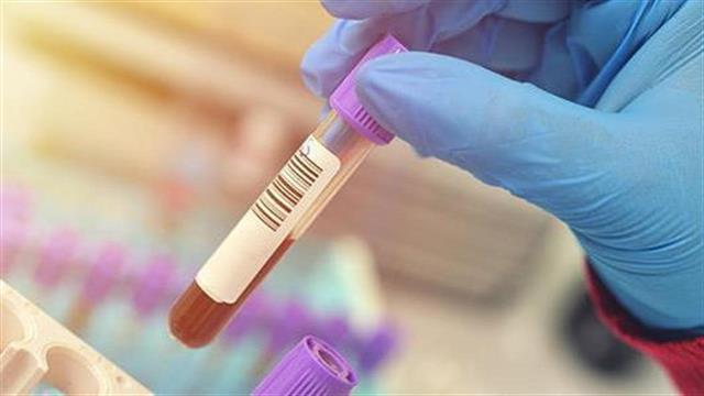 Εξέταση αίματος για πρόβλεψη επιδείνωσης της πολλαπλής σκλήρυνσης