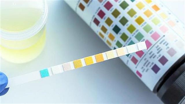Τεστ ούρων μετρά πόσο υγιεινή είναι η διατροφή