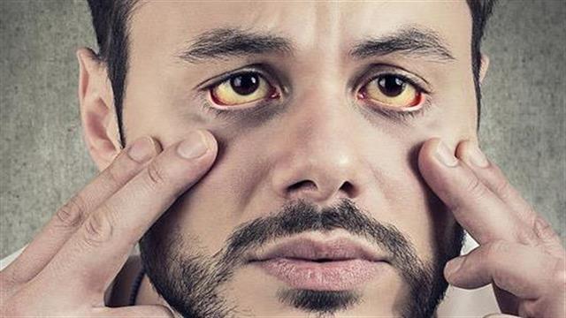 Η Ηπατίτιδα C δεν κοιμάται. Κάνε την εξέταση τώρα!