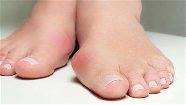 Πώς θεραπεύεται το κότσι