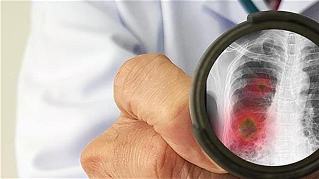 Ανοιχτή επιστολή της Ένωσης Ασθενών Ελλάδας προς τον Πρωθυπουργό για την εθνική στρατηγική απέναντι στην πανδημία