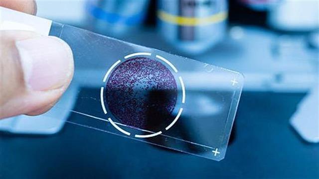 Σύστημα Υβριδικής Απεικόνισης (Fusion Imaging)