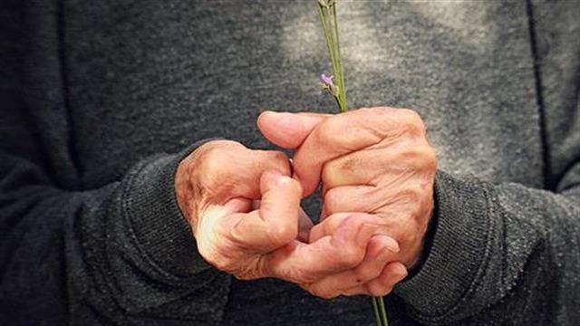 Έξι προβλήματα καθιστούν τους ρευματοπαθείς ασθενείς δεύτερης κατηγορίας